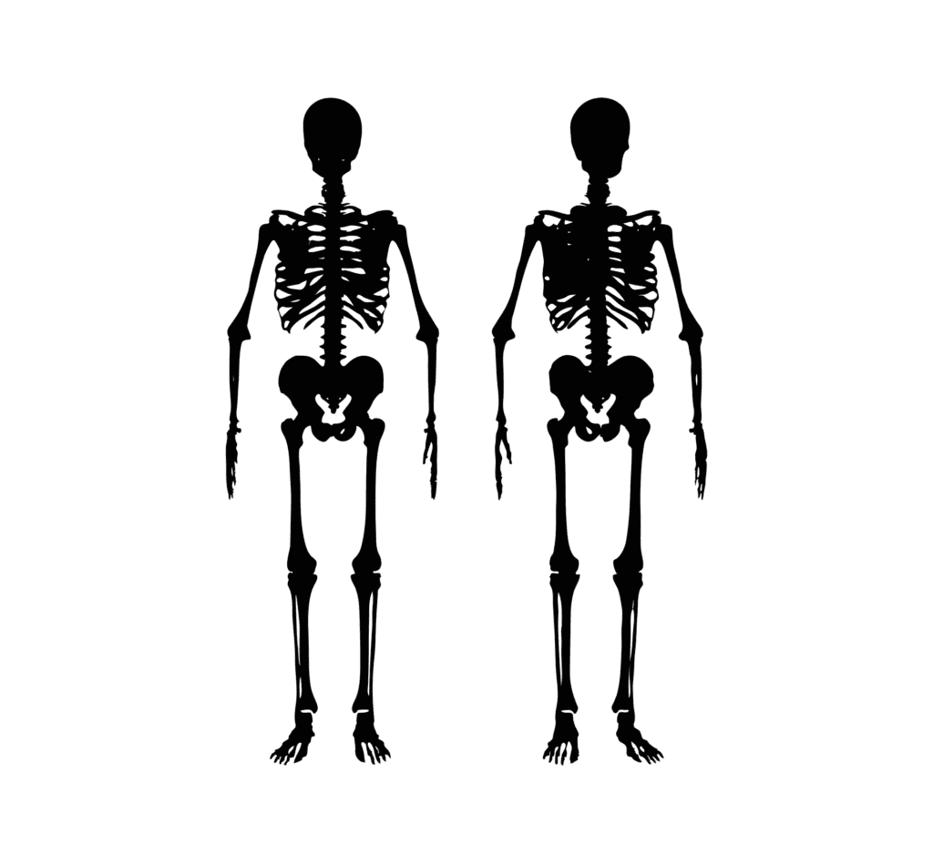 骨質疏鬆症是一種常見骨骼健康的疾病