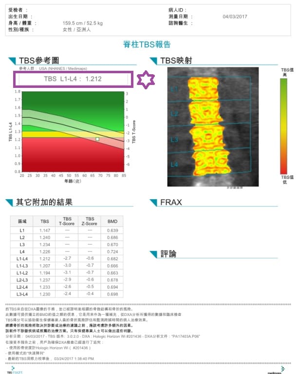 骨品質的重要--骨質密度好但還是2次骨折的真相 3 以DXA檢測骨小樑分數(骨品質)