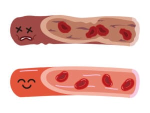 目前較便利使用的動脈硬化檢測儀，稱為肱踝脈波傳導速率(brachial-ankle PWV, baPWV)檢測