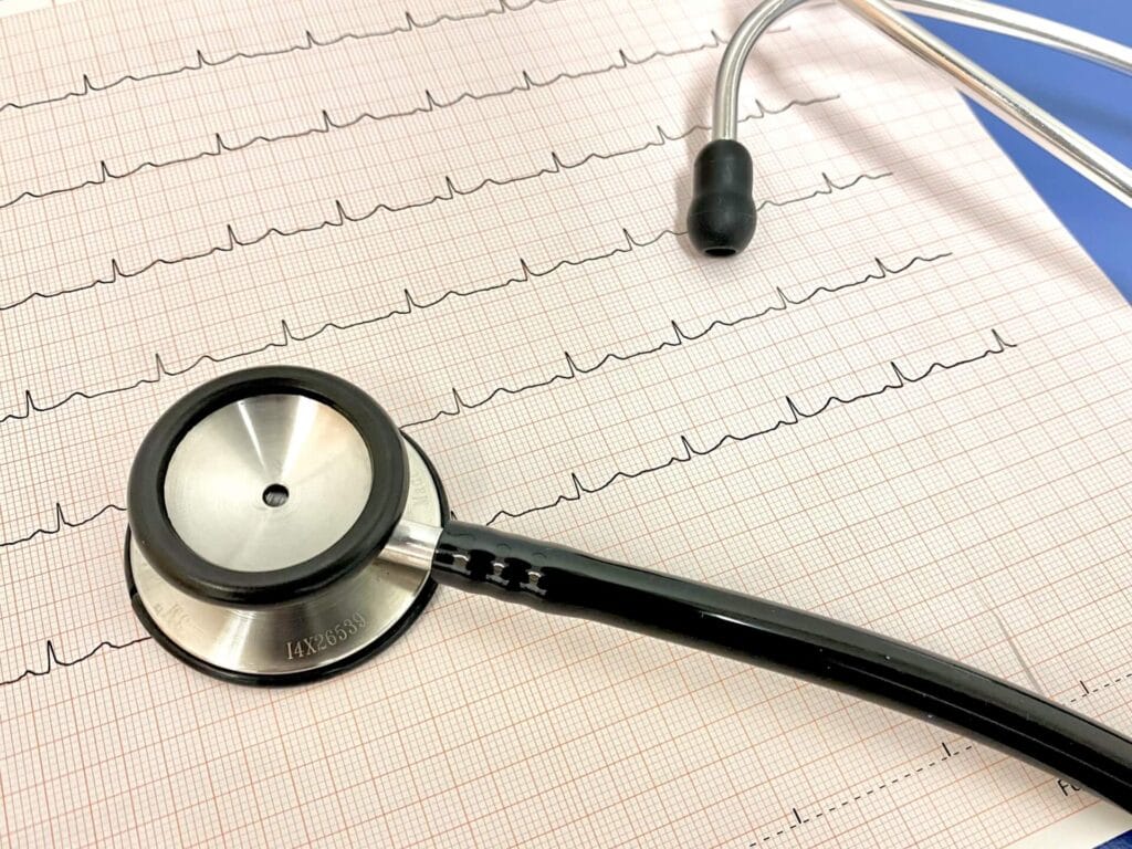 與心臟有關的猝死稱為心因性猝死，是因為心臟停止跳動或是心臟打出的血液不夠，無法維持血液循環以及身體持續運作，造成死亡。根據統計，台灣人發生心因性猝死的機率大約是每一萬人中有5人有危險，男性的風險會比女性高，而發生的時間點高峰是在凌晨六點和中午，另外星期一也是發生心因性猝死較多的日子。